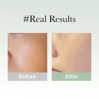 Before and after results for Arencia Holy Hyssop Serum 30