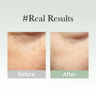 Before and after results for Arencia Holy Hyssop Serum 30