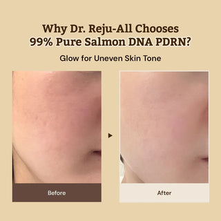 Results of using Dr. Reju-All Advanced PDRN Rejuvenating Cream