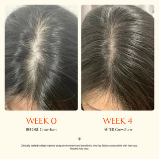 Clinical test results for lilyeve Grow:Turn Exosome Brush Ampoule