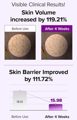Clinical test results for Mary&May Spicule Collagen PDRN Cream