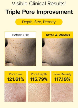 Results of using Mary&May Spicule Retinol PDRN Cream