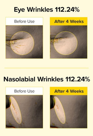 Results of using Mary&May Spicule Retinol PDRN Cream