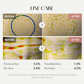 Results of using Medicube Collagen Glow Booster Serum
