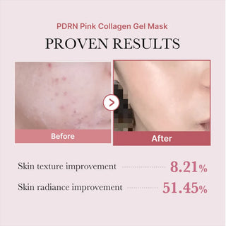 Results of using Medicube PDRN Pink Collagen Gel Mask