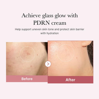 Clinical test results for Medicube PDRN Pink Hyaluronic Moisturizing Cream