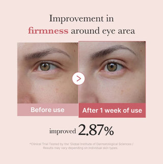 Results of using Medicube PDRN Pink Peptide Eye Cream