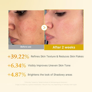 Medicube Kojic Acid Turmeric Resurfacing Toner styled product shot