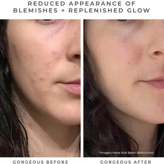 Earth Harbor Naturals OASIS Deep Pore Gel Cleanser: Chlorophyll + Botanical BHA