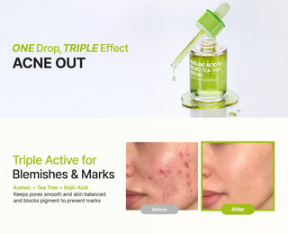 Benefits of PURITO SEOUL Azelaic Acid 10 Kojic Tea Tree Serum