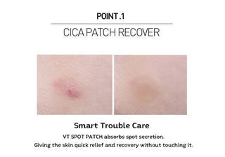 Benefits of VT COSMETICS Spot Patch (48ea)