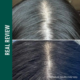 Results of using ViveLab Revive Therapy Hair Scalp & Brow Ampoule